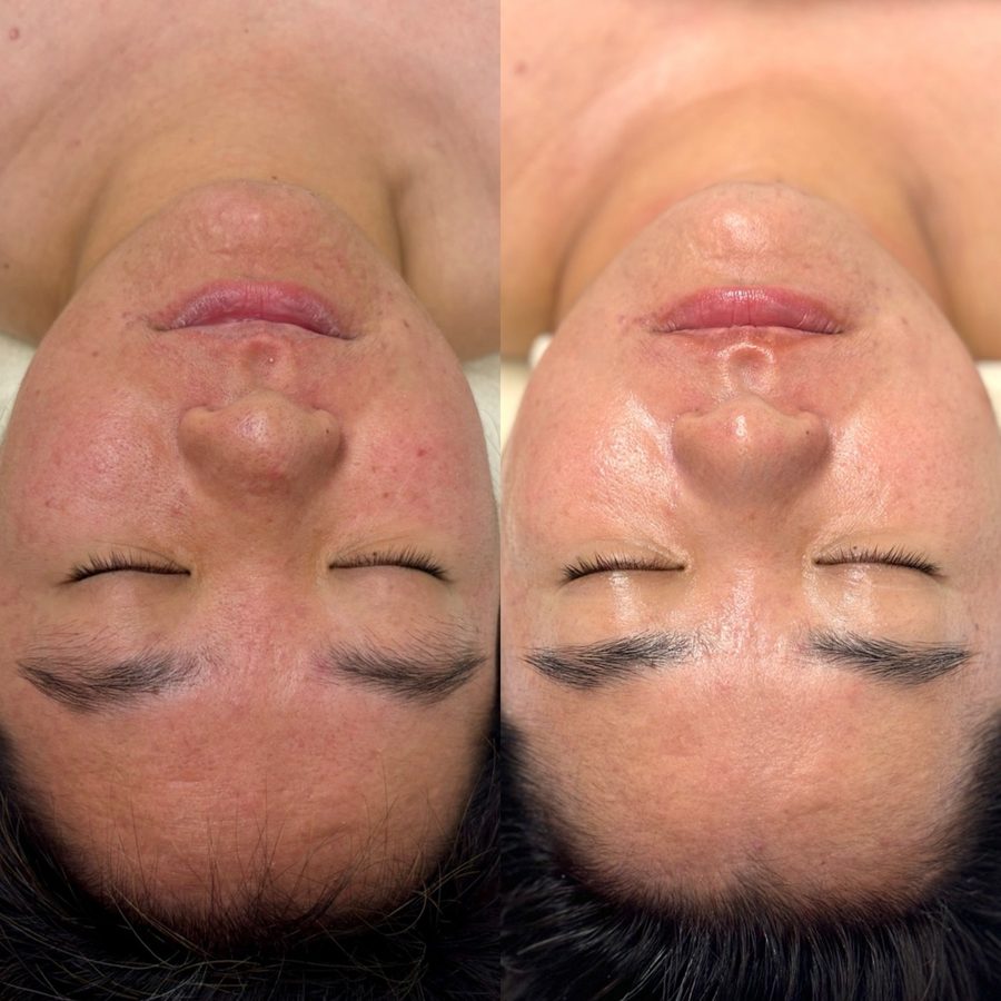 Premium Facial — Hydrating