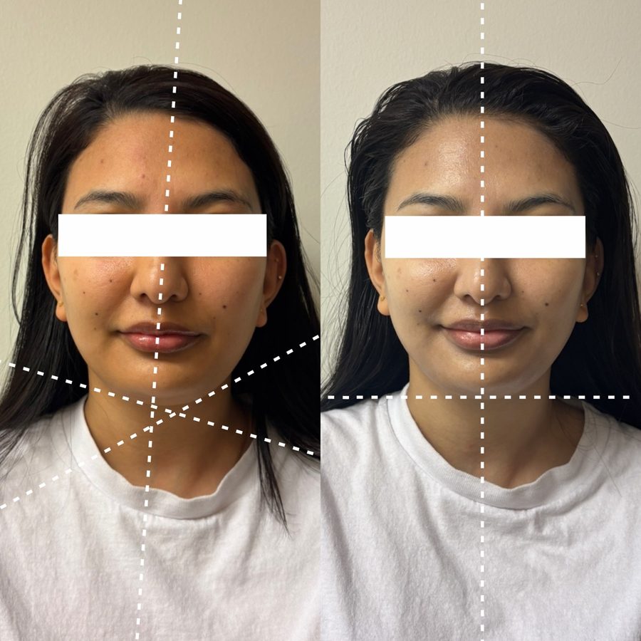 V-Contour